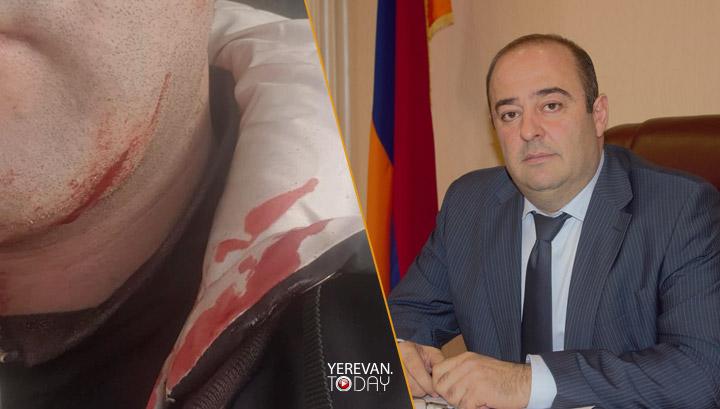 Ստեփանավանի ՔՊ-ական քաղաքապետը փորձել է դանակով կտրել իրեն դիմած քաղաքացու կոկորդը