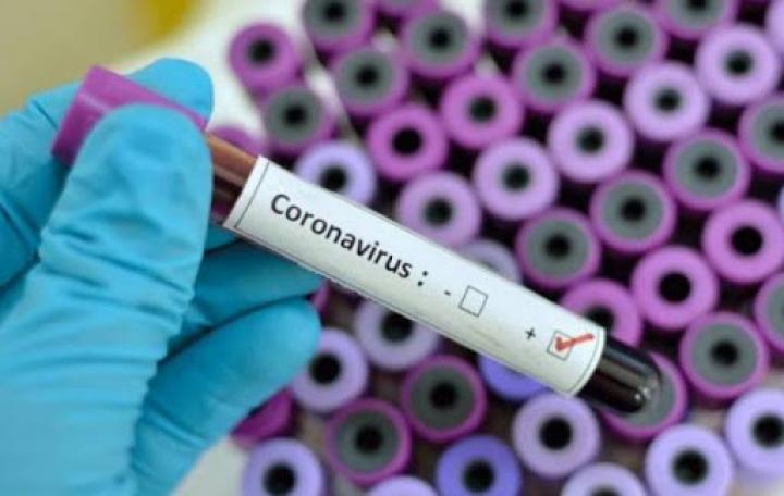 Կորոնավիրուսի 9 դեպք Կապանում, 8 դեպք՝ Մեղրիում․ Սյունիքի մարզպետարան