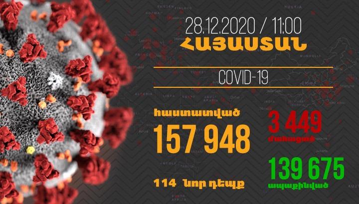 Հայաստանում գրանցվել է կորոնավիրուսի 114 նոր դեպք, մահվան՝ 8