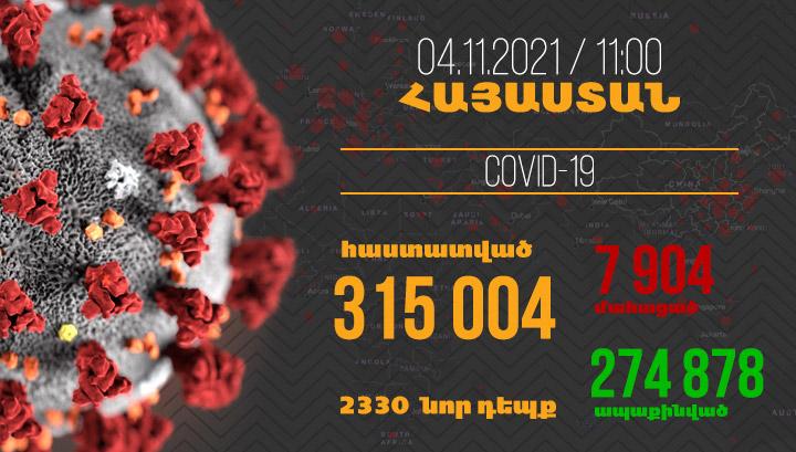 Հայաստանում հաստատվել է կորոնավիրուսով վարակվելու 2330, մահվան՝ 46 նոր դեպք