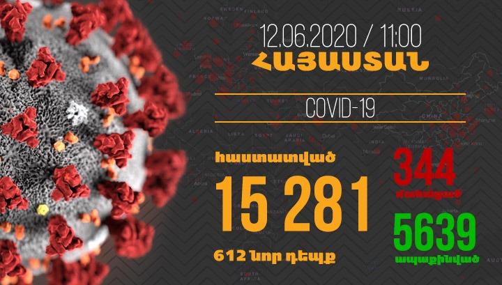 Հայաստանում մեկ օրում գրանցվել է կորոնավիրուսի 612 նոր դեպք և 17 մահ