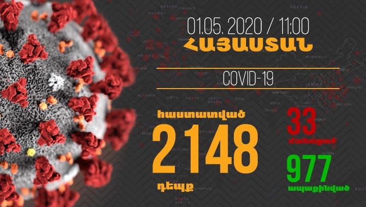 Հայաստանում մեկ օրում գրանցվել է կորոնավիրուսի 82 նոր դեպք և 1 մահ