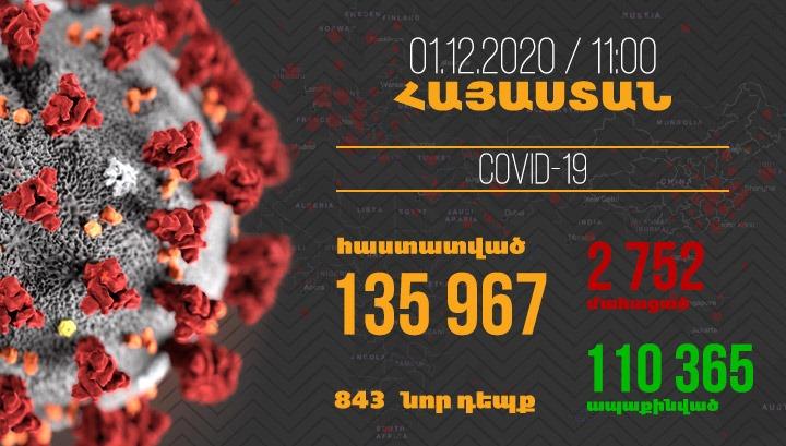 Հայաստանում գրանցվել է կորոնավիրուսի 843 նոր դեպք, մահվան՝ 46