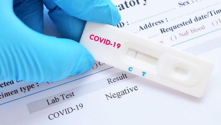 COVID-19-ի թեստավորման գինը կնվազի