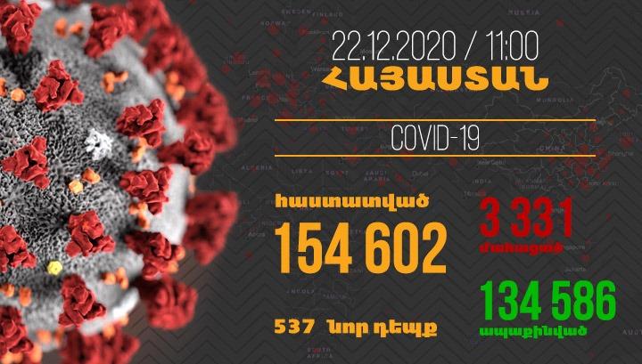 Հայաստանում գրանցվել է կորոնավիրուսի 537 նոր դեպք, մահվան՝ 21