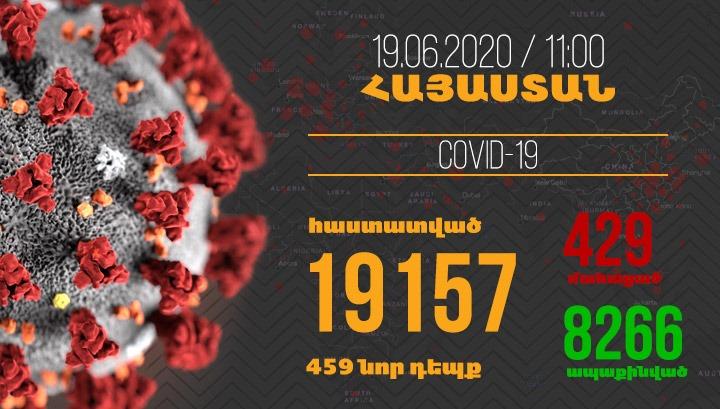 Հայաստանում մեկ օրում գրանցվել է կորոնավիրուսի 459 նոր դեպք, բուժման՝ 706, մահվան՝ 19