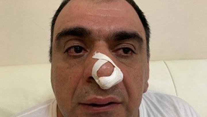 Մոսկվաբնակ գործարարը պնդում է, որ Երևանում Խաչատուր Սուքիասյանի եղբայրն ու թիկնապահն իրեն ծեծի են ենթարկել ․ News.am