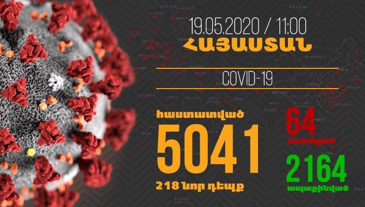 Հայաստանում մեկ օրում գրանցվել է կորոնավիրուսի 218 նոր դեպք և 3 մահ
