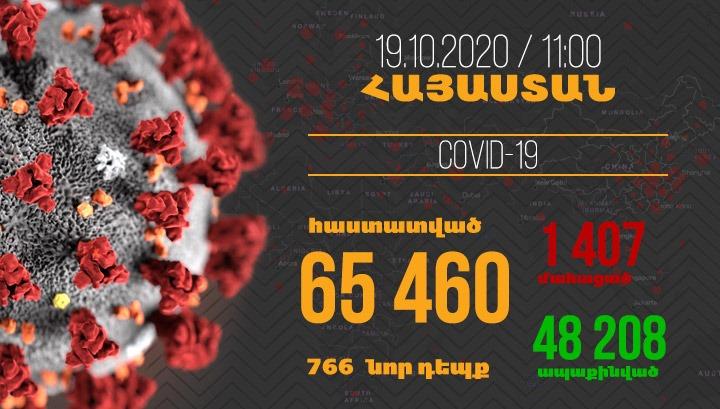 Հայաստանում հաստատվել է կորոնավիրուսի 766, մահվան՝ 10 նոր դեպք