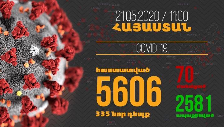 Հայաստանում մեկ օրում գրանցվել է կորոնավիրուսի 335 դեպք և 3 մահ