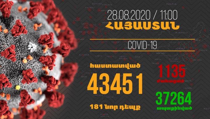 Հայաստանում հաստատվել է կորոնավիրուսի 181 նոր դեպք, մահվան՝ 6