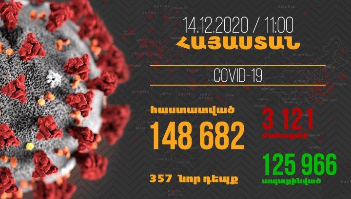 Հայաստանում հաստատվել է կորոնավիրուսի 357 նոր դեպք, մահվան՝ 18