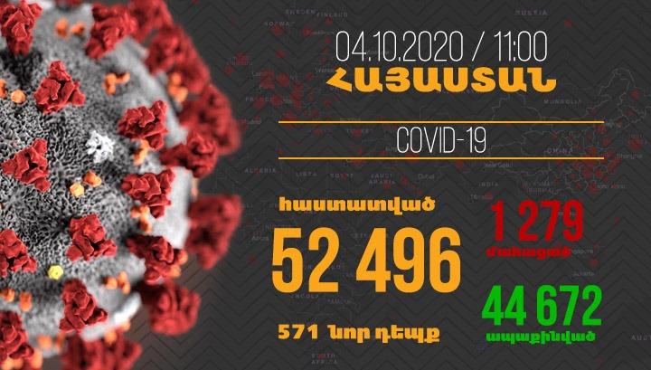Հայաստանում գրանցվել է կորոնավիրուսի 571 նոր դեպք, մահվան՝ 5