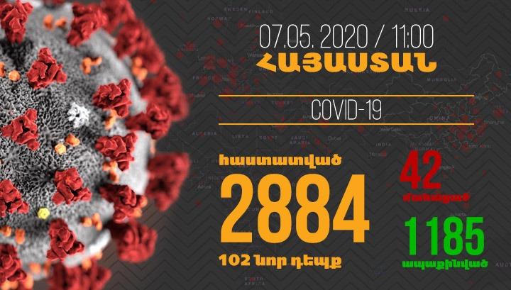 Հայաստանում մեկ օրում գրանցվել է կորոնավիրուսի 102 նոր դեպք և 2 մահ