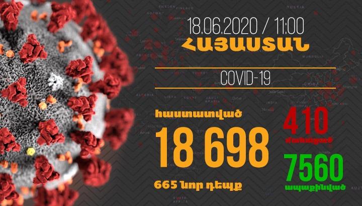 Մեկ օրում հաստատվել է վարակի 665, բուժման՝ 746, մահվան՝ 9 դեպք