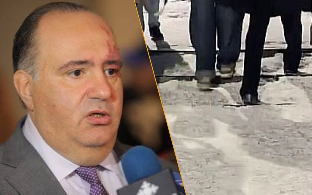 Տիգրան Ավինյան, դուխդ կբավականացնի՞ տուգանես Նիկոլ Փաշինյանի թափառախմբի անդամ «ԿԱԶԱՐՅևԻՉԻՆ». Մանուկյան